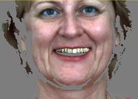 сканирование лица проектирование улыбки